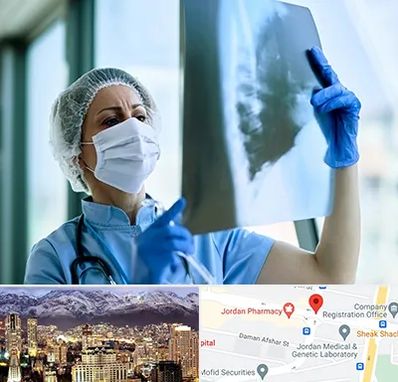 جراح سرطان ریه در جردن 