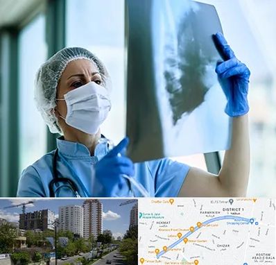 جراح سرطان ریه در اندرزگو 