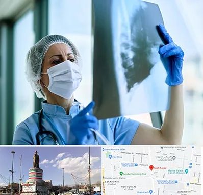 جراح سرطان ریه در کارگر جنوبی 