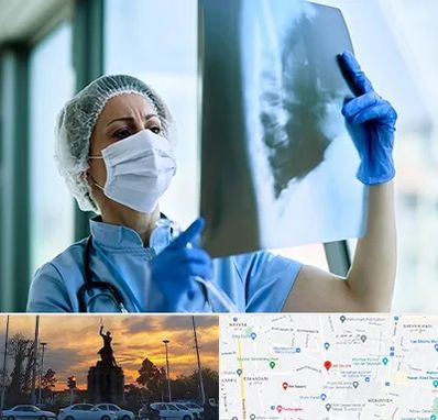 جراح سرطان ریه در میدان حر 