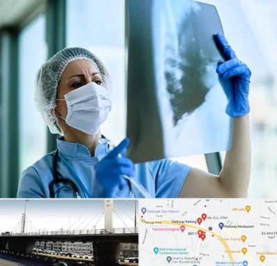 جراح سرطان ریه در پارک وی 