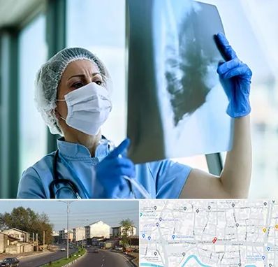 جراح سرطان ریه در ضیابری رشت 