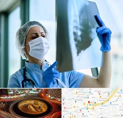 جراح سرطان ریه در میدان ولیعصر 