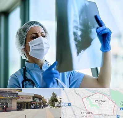 جراح سرطان ریه در پرواز تبریز