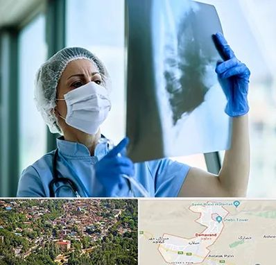 جراح سرطان ریه در دماوند