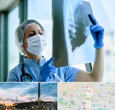 جراح سرطان ریه در منطقه 2 تهران 