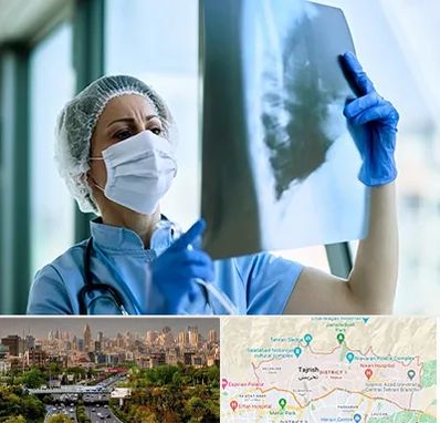 جراح سرطان ریه در منطقه 1 تهران 