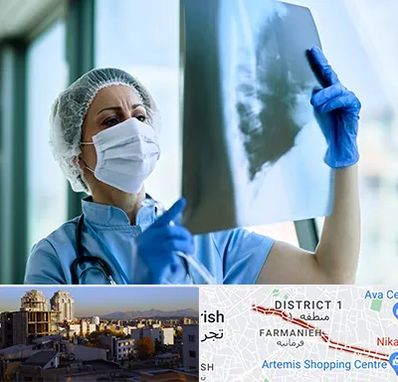 جراح سرطان ریه در فرمانیه 