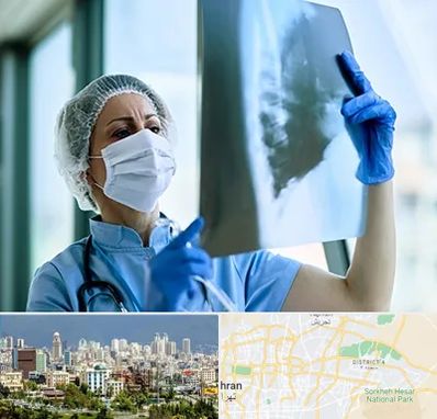 جراح سرطان ریه در شرق تهران 