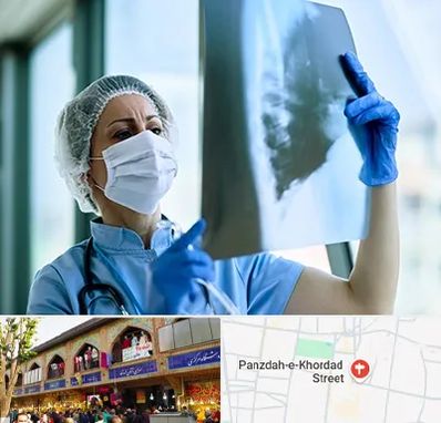 جراح سرطان ریه در 15 خرداد