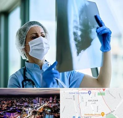 جراح سرطان ریه در گلسار رشت 