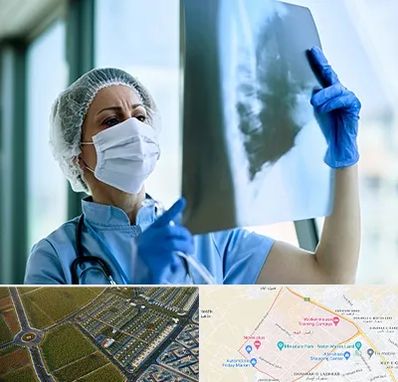 جراح سرطان ریه در الهیه مشهد 