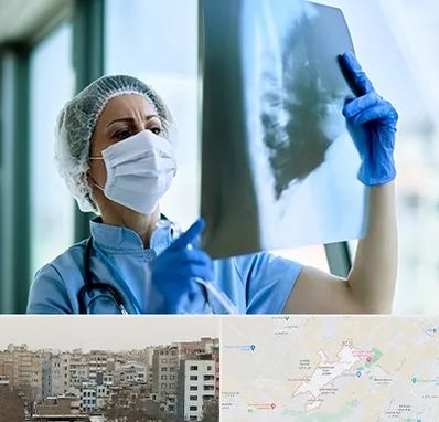 جراح سرطان ریه در محمد شهر کرج 