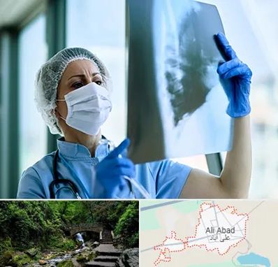 جراح سرطان ریه در علی آباد کتول