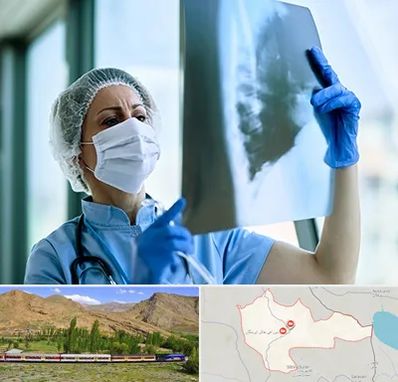 جراح سرطان ریه در خاش