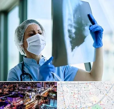 جراح سرطان ریه در منظریه رشت 