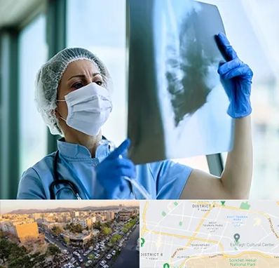 جراح سرطان ریه در تهرانپارس 