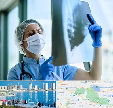 جراح سرطان ریه در چیتگر 