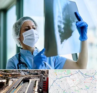 جراح سرطان ریه در ستارخان شیراز 