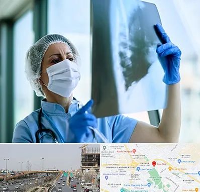 جراح سرطان ریه در بلوار توس مشهد 