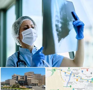 جراح سرطان ریه در صیاد شیرازی مشهد 