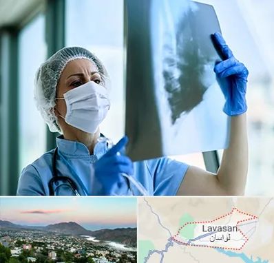 جراح سرطان ریه در لواسان