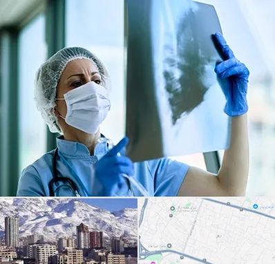 جراح سرطان ریه در ازگل