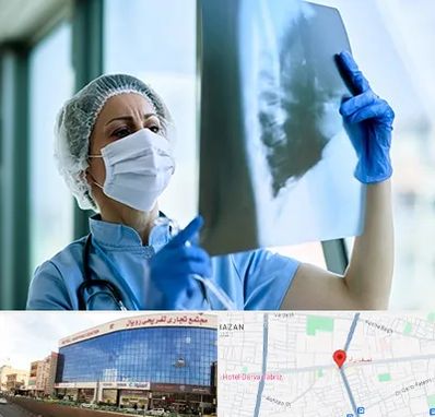 جراح سرطان ریه در نصف راه تبریز