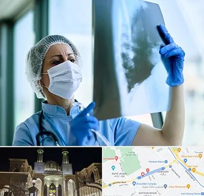 جراح سرطان ریه در زرگری شیراز 