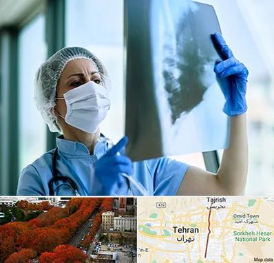 جراح سرطان ریه در ولیعصر 