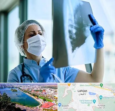 جراح سرطان ریه در لاهیجان