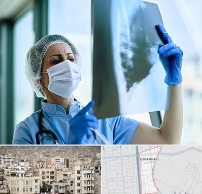 جراح سرطان ریه در اسکندری