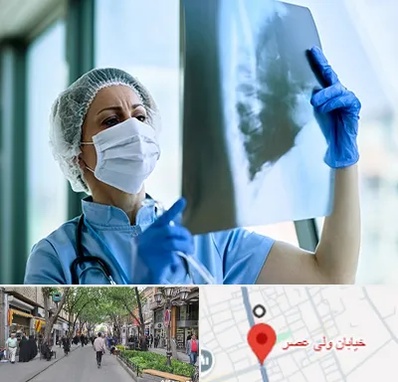 جراح سرطان ریه در ولیعصر شهریار