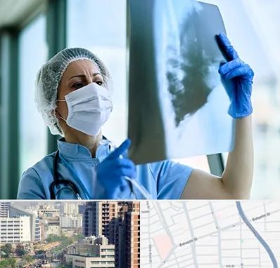 جراح سرطان ریه در خیابان بهشتی