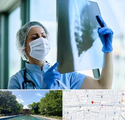 جراح سرطان ریه در هشت بهشت اصفهان 