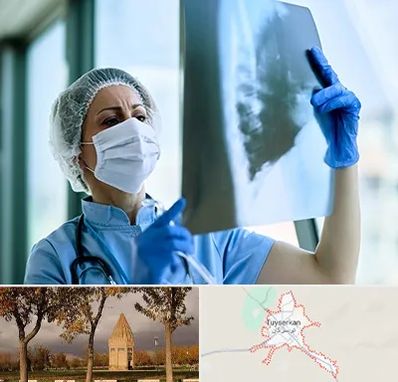 جراح سرطان ریه در تویسرکان