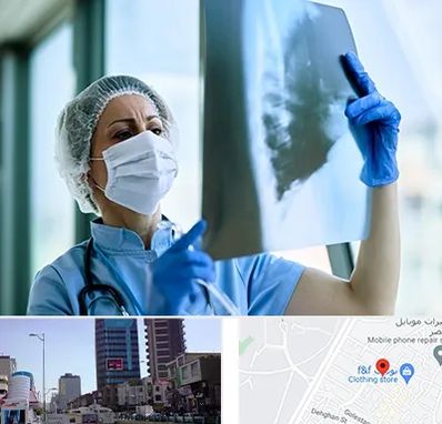 جراح سرطان ریه در چهارراه طالقانی کرج 