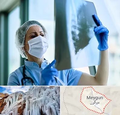 جراح سرطان ریه در میگون