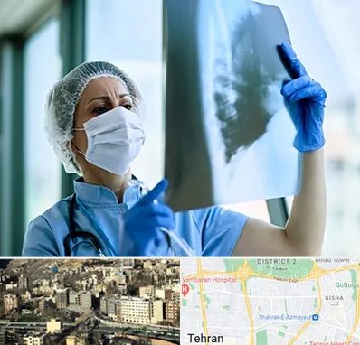 جراح سرطان ریه در مرزداران 