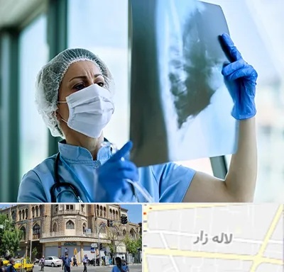 جراح سرطان ریه در لاله زار