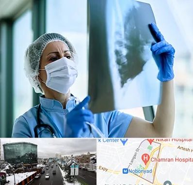 جراح سرطان ریه در اقدسیه 