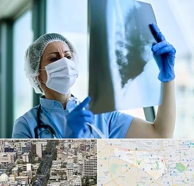 جراح سرطان ریه در منطقه 18 تهران 