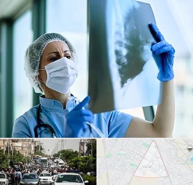 جراح سرطان ریه در سیدی مشهد