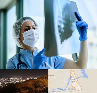 جراح سرطان ریه در میناب
