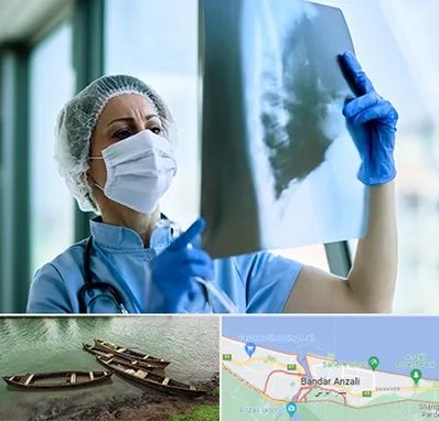 جراح سرطان ریه در بندر انزلی