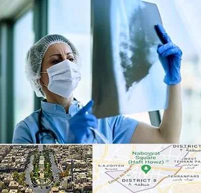 جراح سرطان ریه در نارمک 