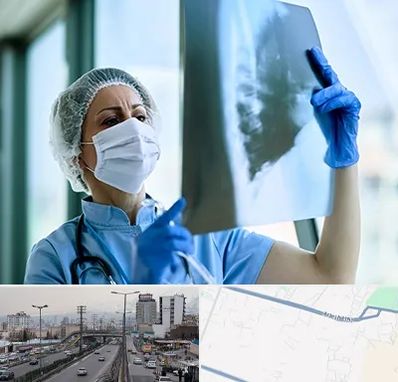 جراح سرطان ریه در بلوار ارتش