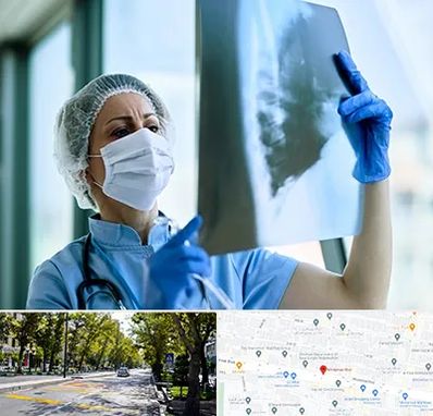 جراح سرطان ریه در میرداماد 