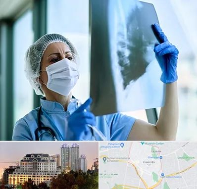 جراح سرطان ریه در فرشته 