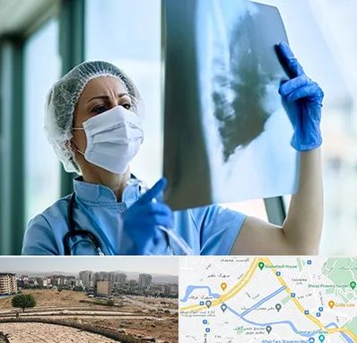 جراح سرطان ریه در کوی وحدت شیراز 